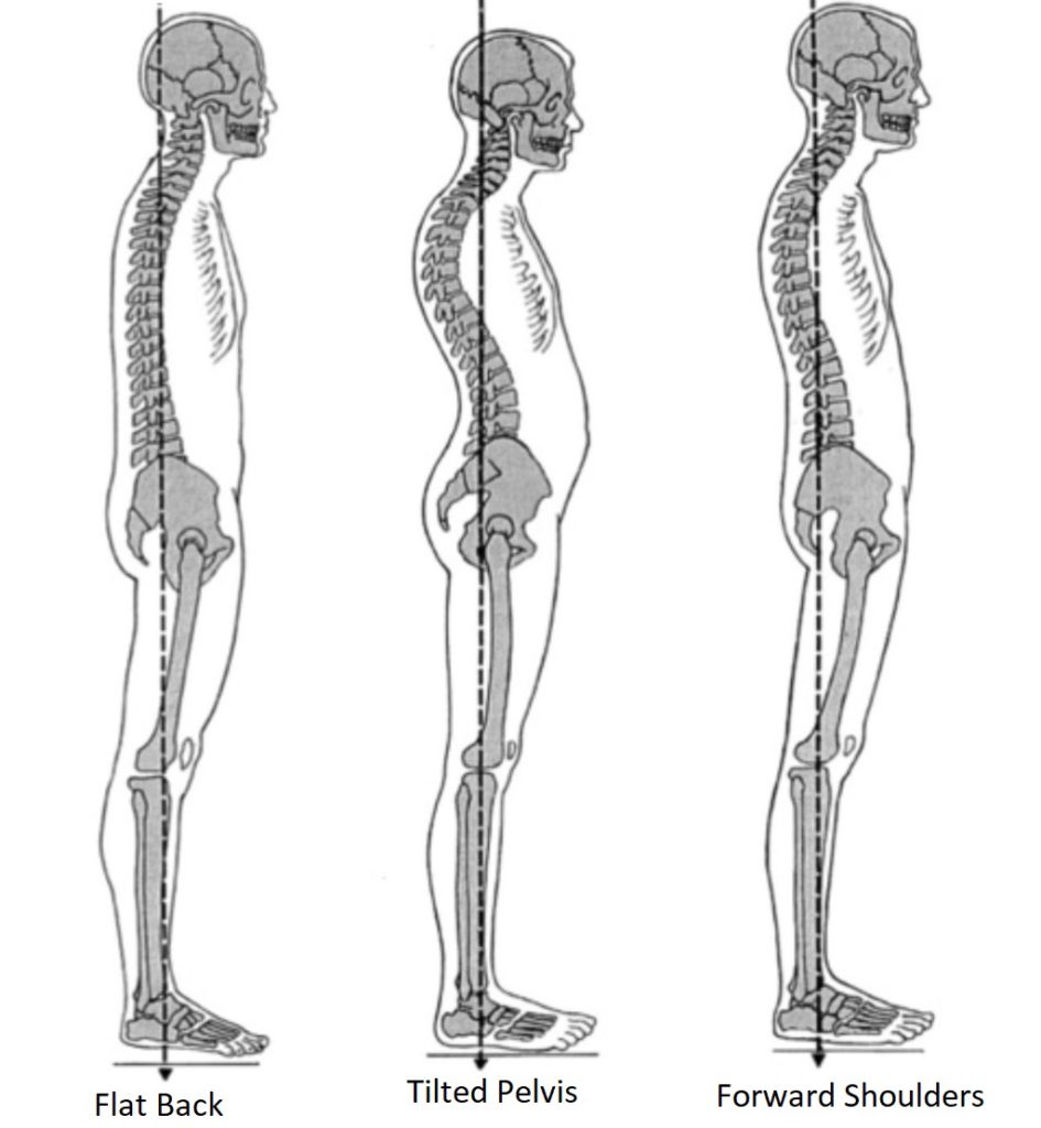 ck-clinic-standing-posture